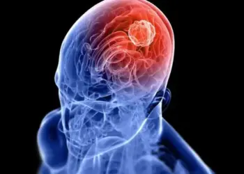 Risk factors of brain tumor: These wrong habits of your daily life can become fatal, change your lifestyle from now on.