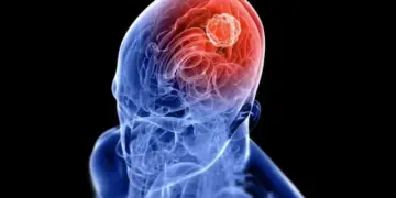 Risk factors of brain tumor: These wrong habits of your daily life can become fatal, change your lifestyle from now on.