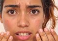 Risk of sunburn increases in strong sunlight, get relief from aloe vera, cucumber and rose water.