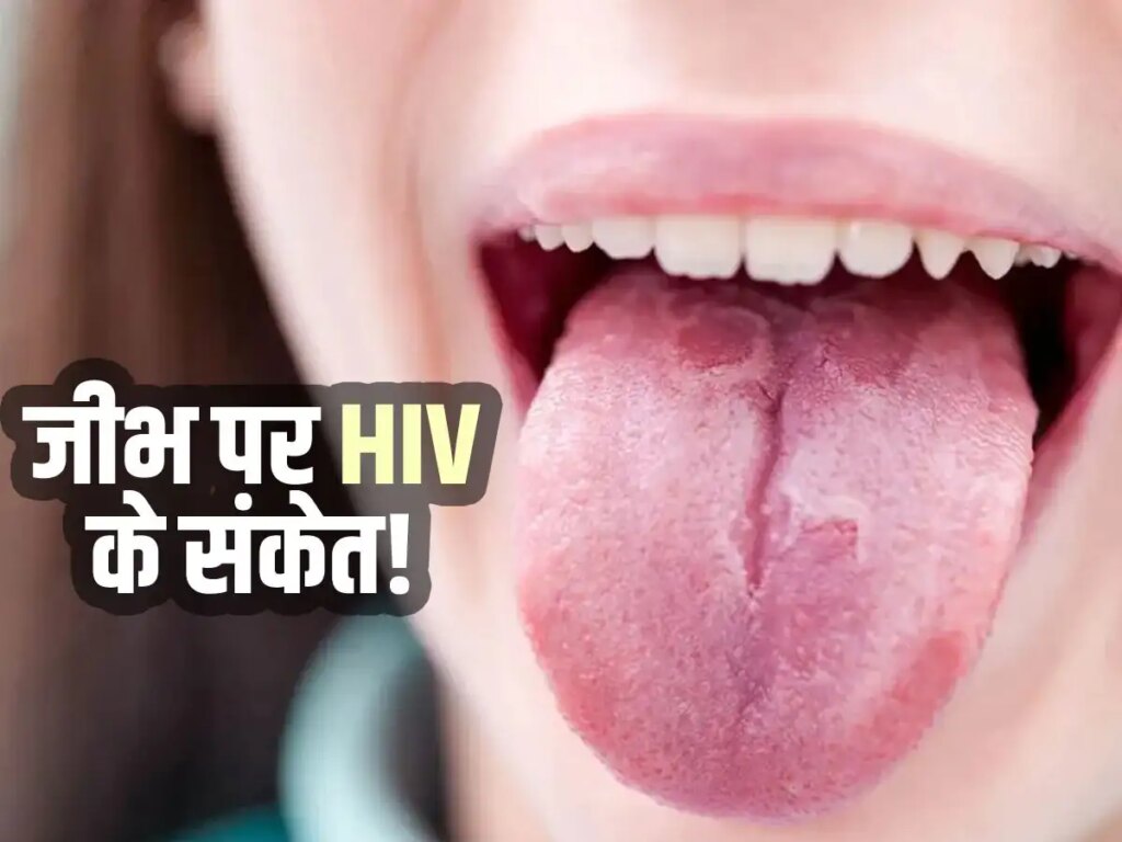 AIDS Symptoms in Women: These major changes can be seen in the body after HIV infection in women, signs of skin and tongue are also important