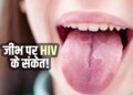 AIDS Symptoms in Women: These major changes can be seen in the body after HIV infection in women, signs of skin and tongue are also important