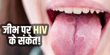 AIDS Symptoms in Women: These major changes can be seen in the body after HIV infection in women, signs of skin and tongue are also important