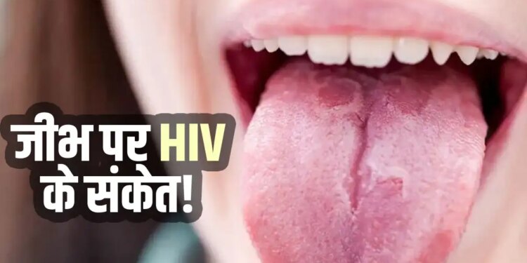AIDS Symptoms in Women: These major changes can be seen in the body after HIV infection in women, signs of skin and tongue are also important