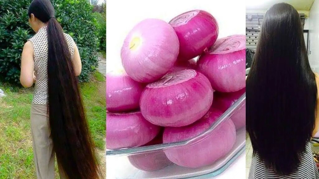Are you troubled by hair fall in rain? Learn the easy way to make onion oil at home, you will also get relief from dandruff and white hair.