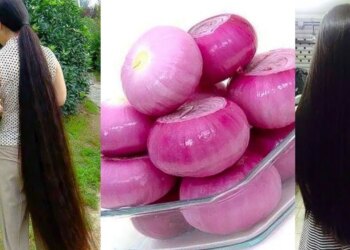 Are you troubled by hair fall in rain? Learn the easy way to make onion oil at home, you will also get relief from dandruff and white hair.