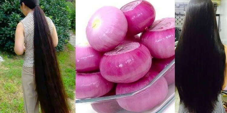 Are you troubled by hair fall in rain? Learn the easy way to make onion oil at home, you will also get relief from dandruff and white hair.