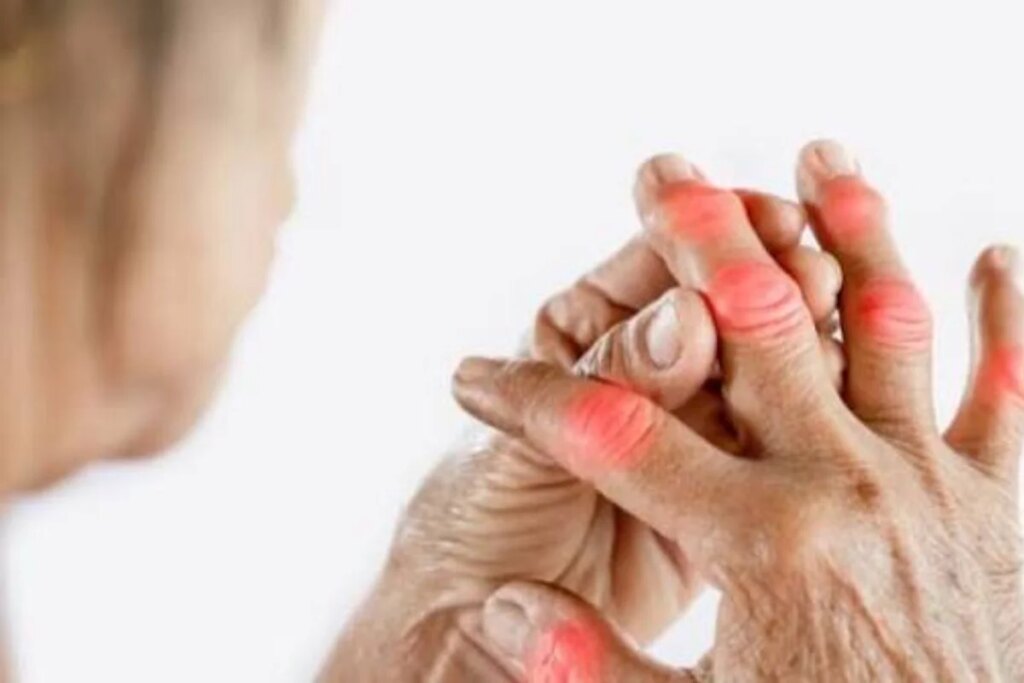 Calcium deficiency can become the enemy of bones! Know the important measures for strong bones and teeth