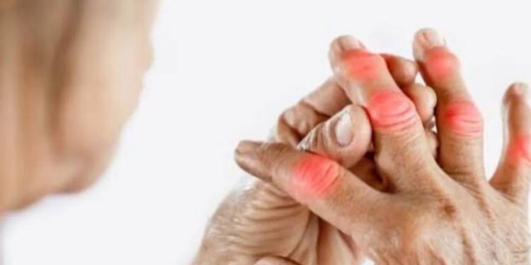 Calcium deficiency can become the enemy of bones! Know the important measures for strong bones and teeth