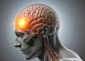 Frequent headache can be an alarm bell, do not ignore it even by mistake.