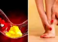 High cholesterol can increase the risk of heart disease, know which habits are the biggest reason for this.