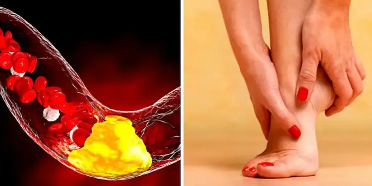 High cholesterol can increase the risk of heart disease, know which habits are the biggest reason for this.