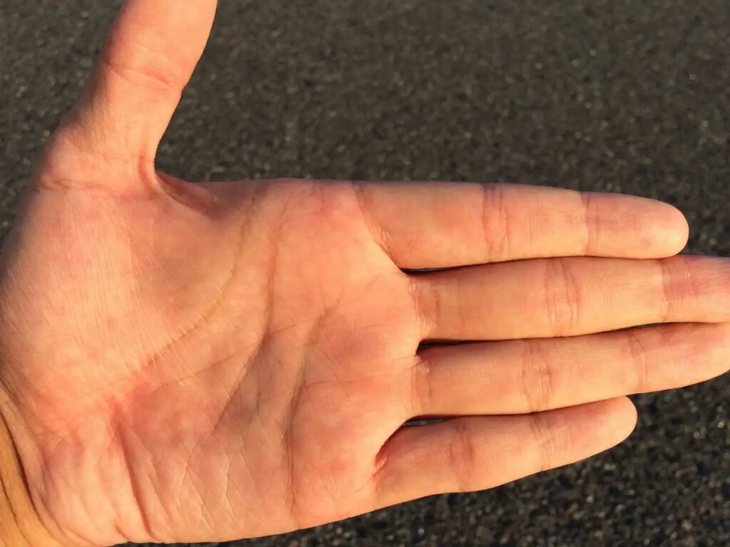 Marriage Line Palmistry: Where is the marriage line in the palm? Know which line is considered auspicious and what the palmistry signs say