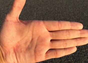Marriage Line Palmistry: Where is the marriage line in the palm? Know which line is considered auspicious and what the palmistry signs say