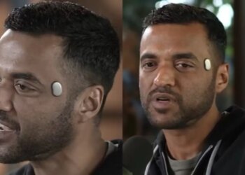 New explosion in the world of technology, the gadget worn on the forehead will do many smart things, know the price and features