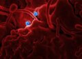 Started taking TB medicine after seeing X-ray, later found another disease, experts advised caution