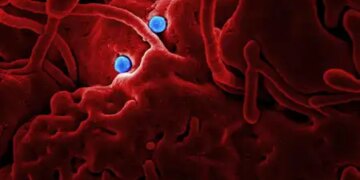 Started taking TB medicine after seeing X-ray, later found another disease, experts advised caution
