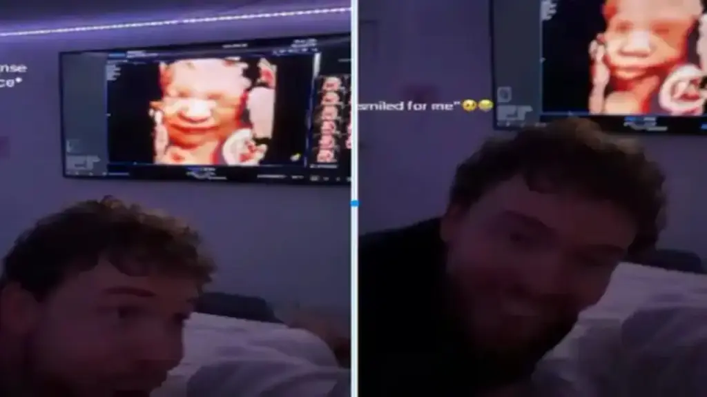 VIRAL VIDEO: Child gave a cute reaction in the womb after hearing father's voice, people got emotional after seeing the unique moment