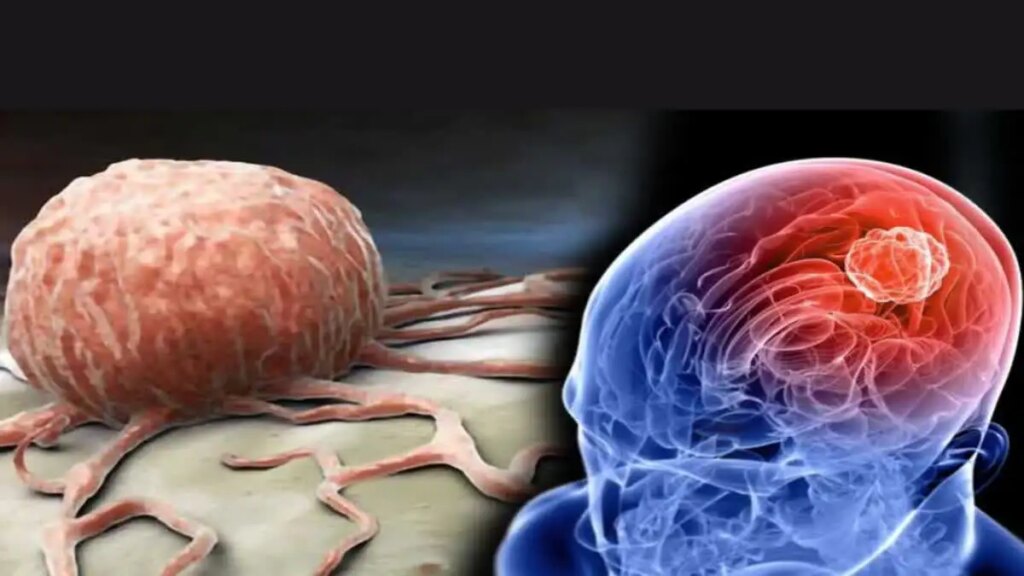 WHO Brain Health Tips: Want to avoid the problem of forgetting? Adopt these easy habits to keep your brain healthy