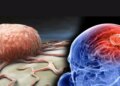 WHO Brain Health Tips: Want to avoid the problem of forgetting? Adopt these easy habits to keep your brain healthy