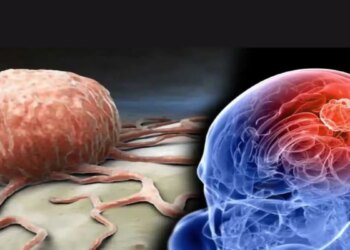WHO Brain Health Tips: Want to avoid the problem of forgetting? Adopt these easy habits to keep your brain healthy