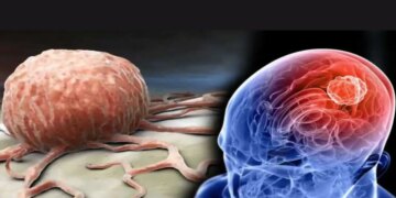 WHO Brain Health Tips: Want to avoid the problem of forgetting? Adopt these easy habits to keep your brain healthy