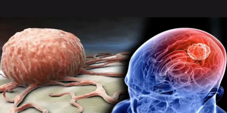 WHO Brain Health Tips: Want to avoid the problem of forgetting? Adopt these easy habits to keep your brain healthy